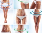 Criolipoliza – Tratamentul de slabire care iti ingheata grasimea