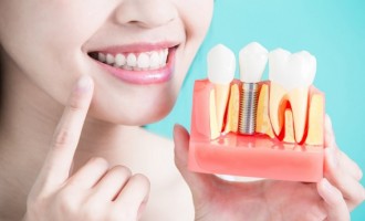 Cum ne poate ajuta implantul dentar să avem un zâmbet impecabil şi o viaţă normală?