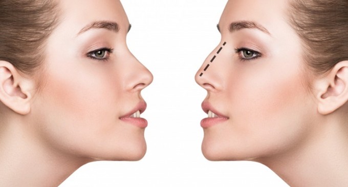 Corecteaza micile imperfectiuni