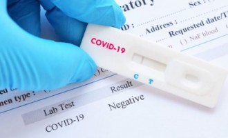 Testează-te singur acasă, ca să afli dacă te-ai infectat cu Sars-Cov-2!