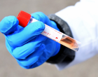Bomba medicala: de ce infectarile apar numai la testele de stat?
