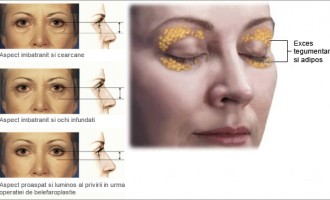 3 Proceduri cosmetice care te vor ajuta sa arati bine de sarbatori