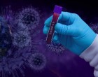 Teste rapide pentru coronavirus