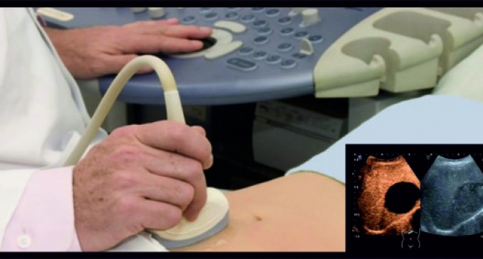 Ce trebuie sa stii despre ecografia cardiaca cu substanta de contrast?