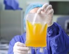 Săptămâna Mondială a Donării de Plasmă: Statul român nu are nici cea mai mică preocupare privind colectarea de plasmă, deși are în continuare monopolul – Sanatate