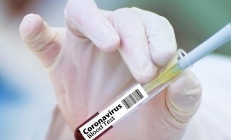 Bărbat din Buzău, condamnat la închisoare cu executare pentru că a fugit din spital înainte de rezultatul testului pentru Covid-19. El nu era infectat cu coronavirus – Esential