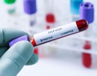 Cinci cazuri de infectare cu noua variantă de coronavirus, identificate în Japonia – Coronavirus