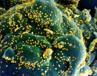 COVID-19: Noi studii științifice, dar și o informație despre urmările foarte grave ale lipsei măsurilor preventive – Coronavirus