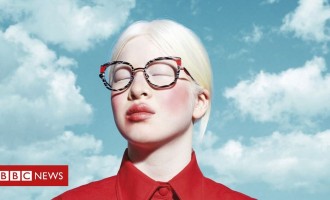 Povestea fetiței orfane ”Frumoasă ca Zăpada” născută în China și ajunsă fotomodel Vogue – International