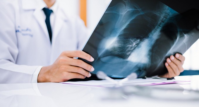 Cercetătorii au făcut un pas uriaș înspre combaterea simptomelor pe termen lung ale Covid, inclusiv a reducerii capacității pulmonare – Coronavirus