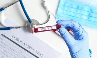Marea Britanie şi Israelul demarează programe de testare a populaţiei pentru determinarea anticorpilor Covid-19 – Coronavirus