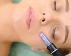Tratamentele dermatologice cu Dermapen – Ziarul Nationalul