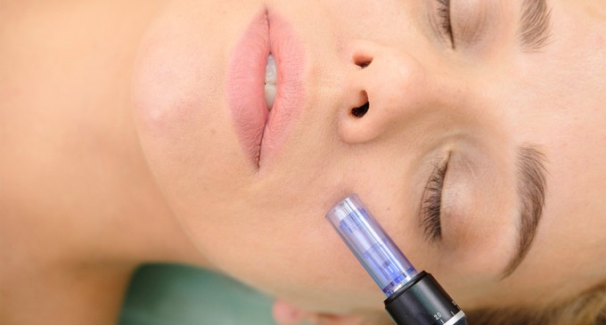 Tratamentele dermatologice cu Dermapen – Ziarul Nationalul