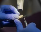 Cât mă costă să merg la dentist în 2022?