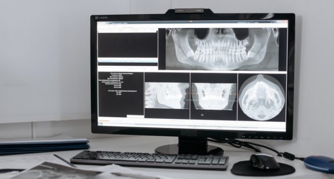 7 indicații pentru realizarea unei radiografii dentare panoramice