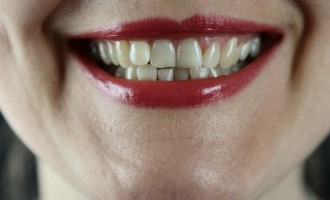 Cum poți preveni apariția parodontozei?