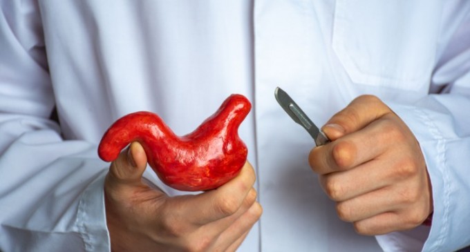 Gastric sleeve: Ce trebuie să știi despre micșorarea de stomac