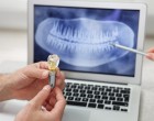 De la ce vârstă putem apela la montarea implanturilor dentare