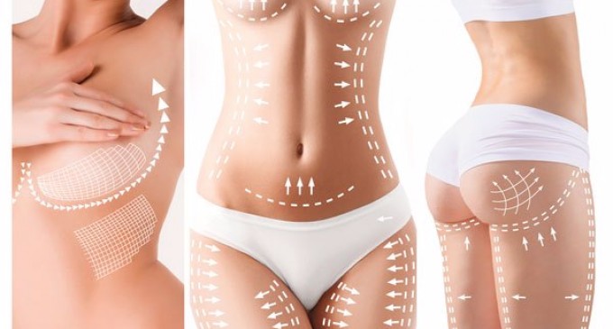 Tot ce trebuie sa stii despre liposuctie