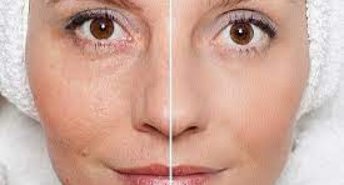 La ce te poate ajuta un aparat profesional de rejuvenare faciala