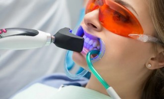 Procesul de albire dentară profesională: Ce trebuie să știți