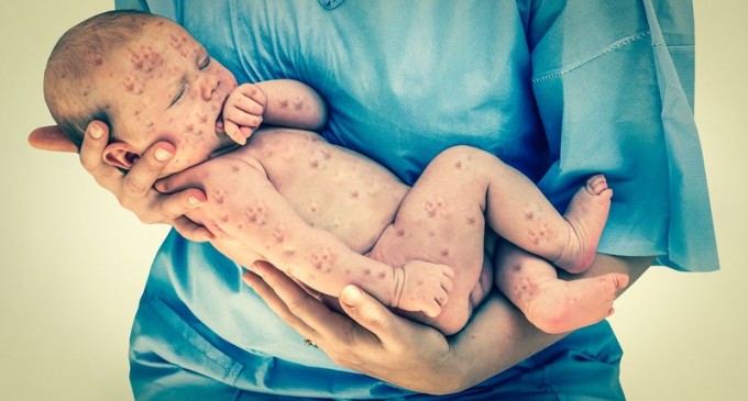 Numărul deceselor provocate de rujeolă în România crește la 3: doi bebeluși și un adult de 35 de ani din București