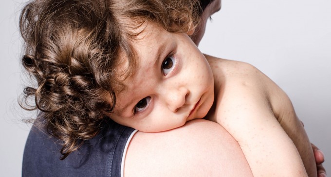 Peste 760 de cazuri noi de rujeolă / Un copil de 10 luni din Bucureşti, nevaccinat, a murit