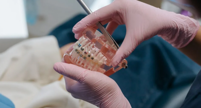 Cât timp se poartă aparatul dentar