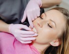 TOP 6 sfaturi esențiale pentru a menține efectele albirii dentare mai mult timp