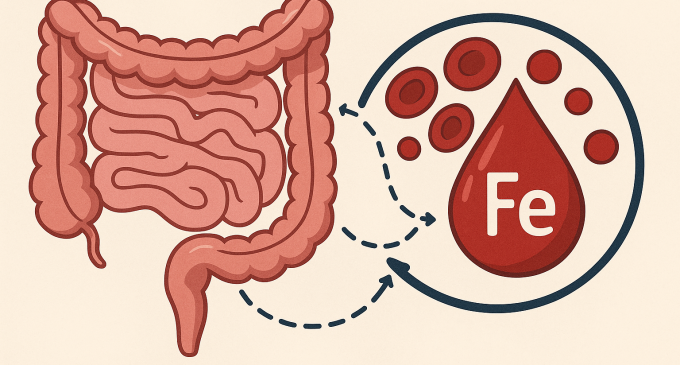 Legătura dintre intestin și deficitul de fier: Anemia prezentă chiar și cu o dietă adecvată