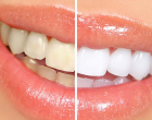 De ce să nu amânați vizita la clinica dentară