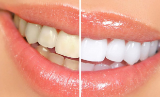 De ce să nu amânați vizita la clinica dentară