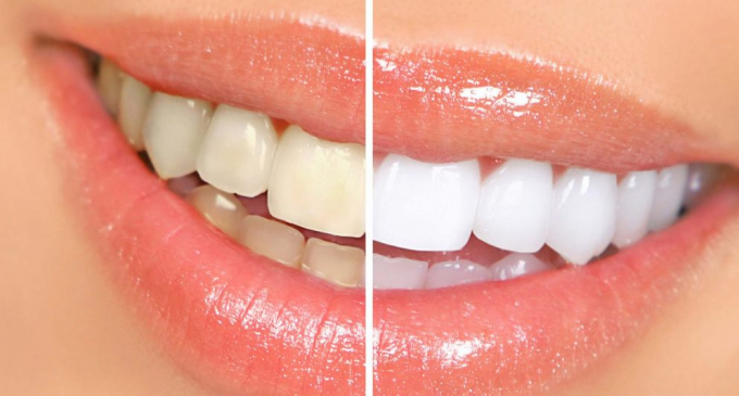 De ce să nu amânați vizita la clinica dentară