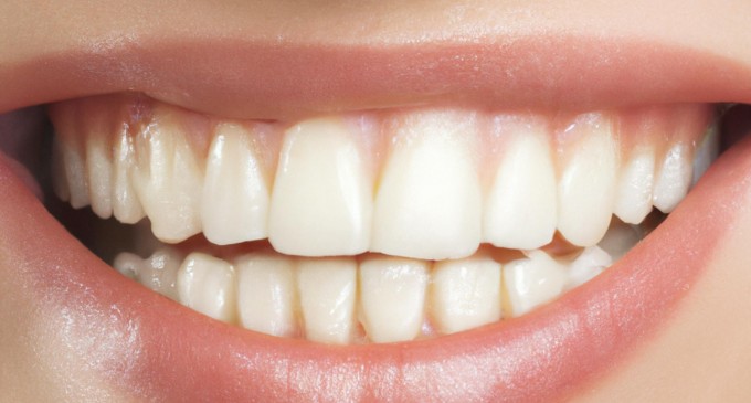 Când este momentul pentru o transformare completă a zâmbetului