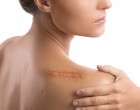 Top 5 mituri despre corectarea cicatricilor demontate de chirurgi