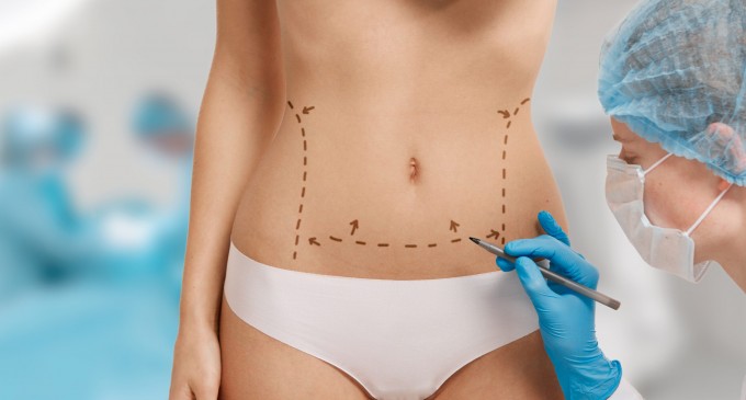 Corpul tău, regulile tale: Ghidul tău despre liposucție și abdominoplastie