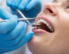 Dentist Constanța: Ghidul Tău Complet Pentru un Zâmbet Sanatos