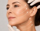 Ce rezultate poate oferi un lifting facial și cât timp se mențin