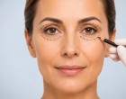 Blefaroplastie: când este recomandată și la ce rezultate te poți aștepta