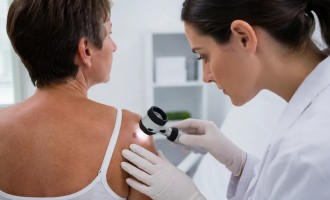 Tumori cutanate: cum le recunoști, când este necesară evaluarea medicală și ce opțiuni de tratament există