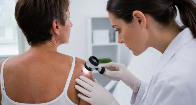 Tumori cutanate: cum le recunoști, când este necesară evaluarea medicală și ce opțiuni de tratament există