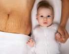 Pielea lăsată după slăbire sau sarcină? Ce soluții există și cum o alegi pe cea potrivită