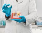 Ce este un bont protetic pentru implant dentar și cum îl alegi corect? Ghid explicat de specialiști