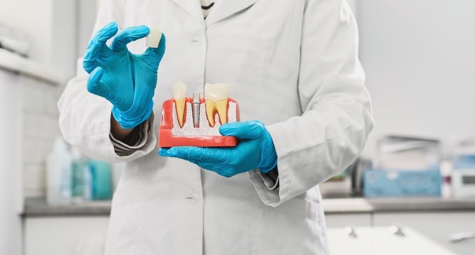 Ce este un bont protetic pentru implant dentar și cum îl alegi corect? Ghid explicat de specialiști