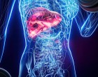 Wegovy® a redus grăsimea din ficat la valori normale la aproape 9 din 10 participanți cu obezitate și steatoză, într-o analiză prezentată la EASD 2026