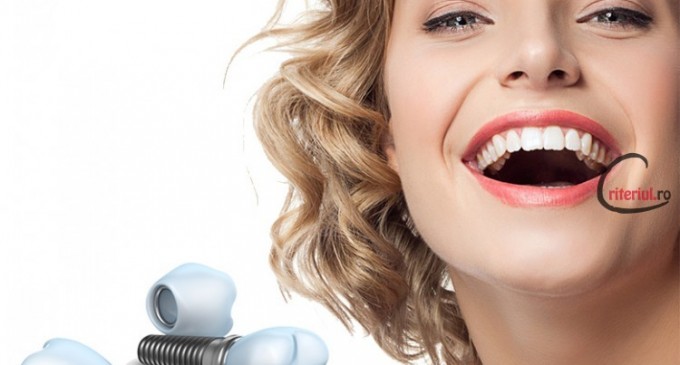 De ce ar trebui sa optezi pentru un implant dentar Straumann?